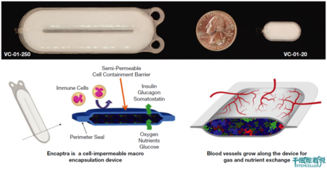 治愈糖尿病的新希望:胰岛细胞封装术