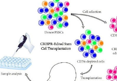 终于有希望了 中国首次完成基因编辑干细胞治疗艾滋病白血病
