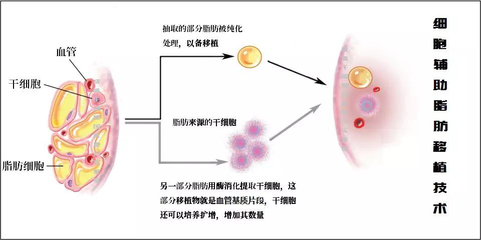 当干细胞技术遇到了美容--脂肪干细胞化身成大明星